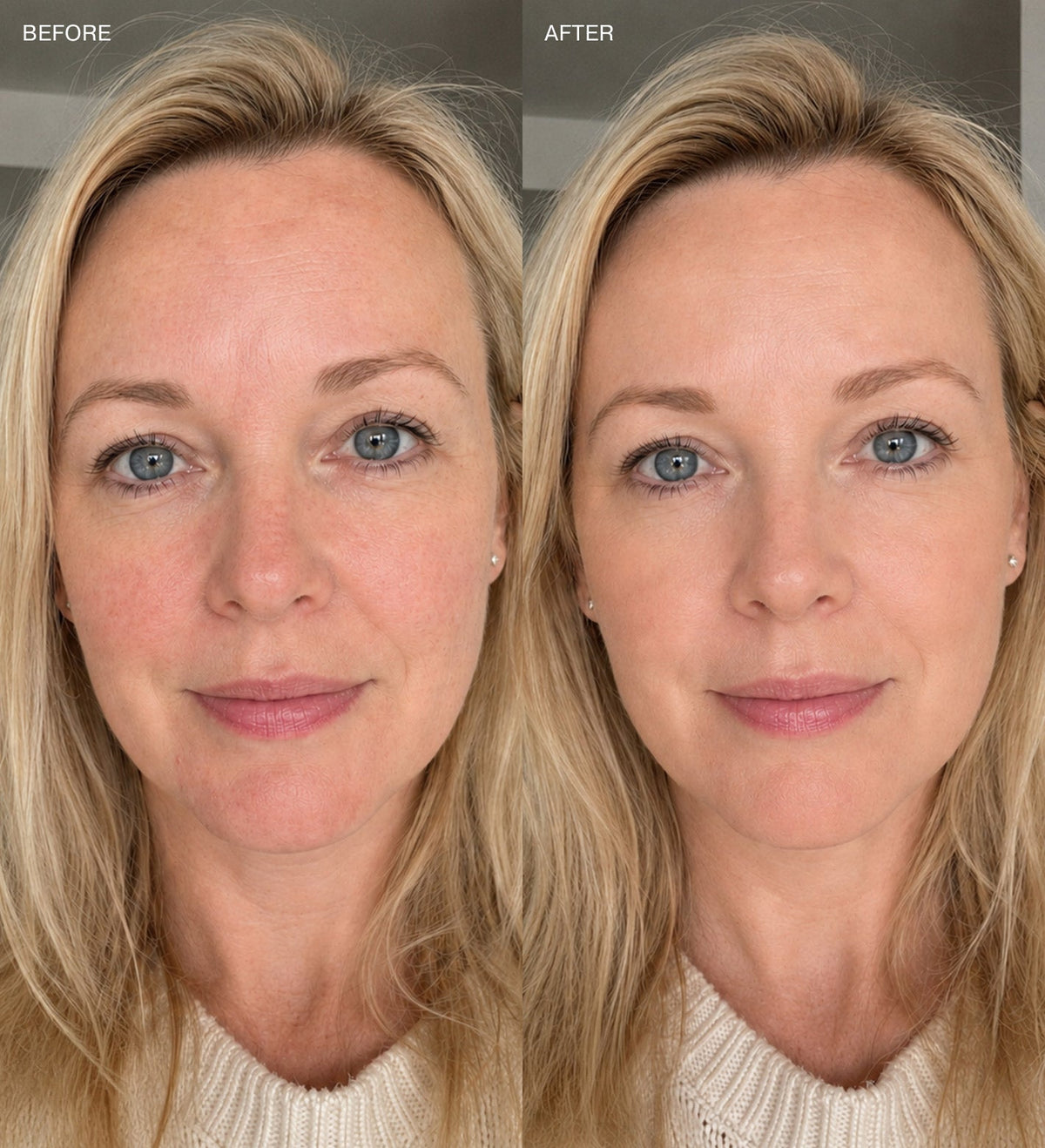 Before and after results using Changing Foundation to conceal redness and create an even complexion.